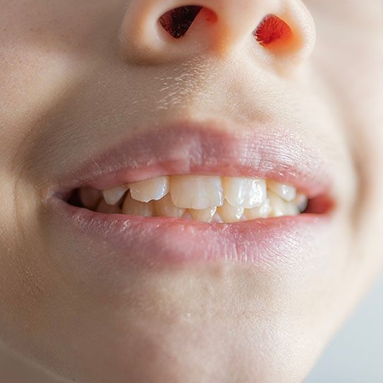 Hummelgard Dentistry -