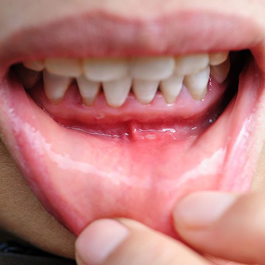 Hummelgard Dentistry -